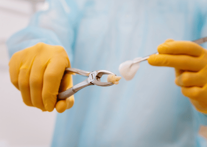 tooth extraction