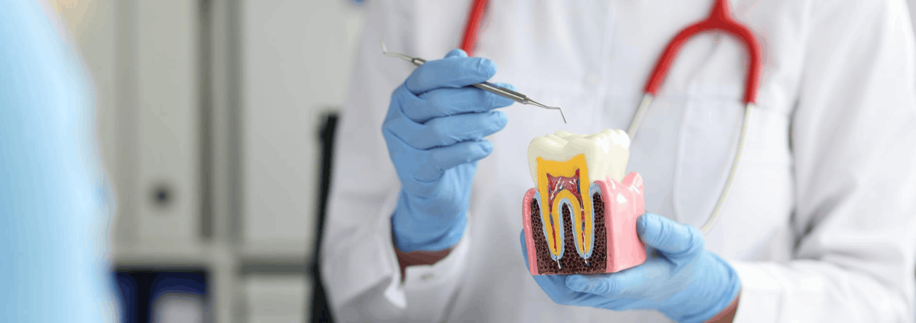 Root Canal Treatment