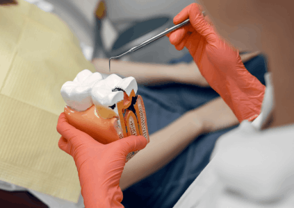 Root canal treatment